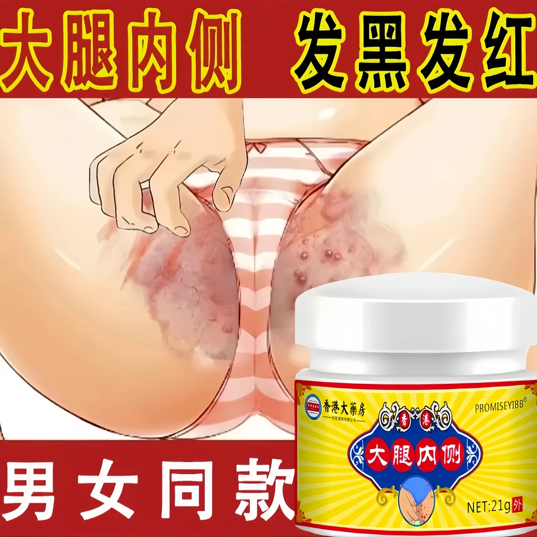 股痒膏大腿内侧瘙痒止痒膏男女专用股沟缝潮湿痒真菌喷剂正品克星