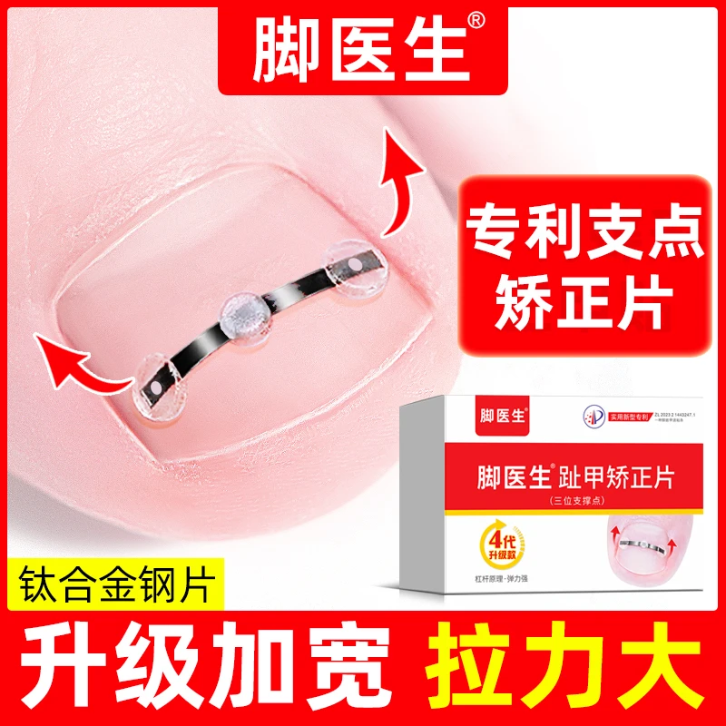 JIAOYISHENG/脚医生趾甲嵌甲矫正丝嵌甲甲沟炎正甲贴片趾甲扎肉