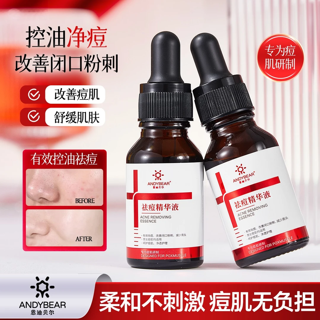 恩迪贝尔祛痘精华液通用祛痘控油舒缓减少黑头闭口粉刺青春痘男女