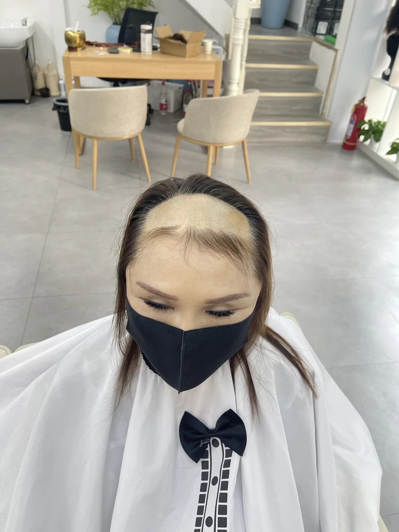 女士假发 头顶稀疏 真人发丝粘贴式补发量身定制