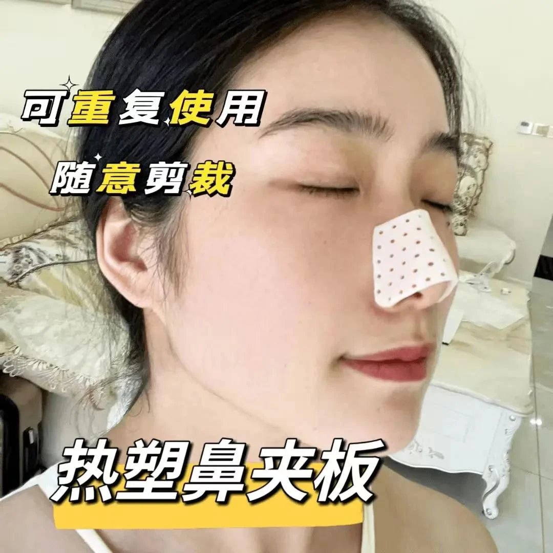 热塑鼻夹板自捏塑形鼻夹板大鼻孔神器自适应佩戴不掉个人用品