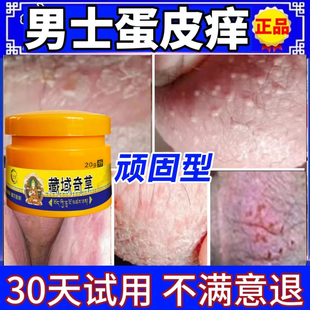 男人私处下体蛋蛋痒大腿内侧阴囊起乌龟皮疙瘩真菌王瘙痒止痒膏