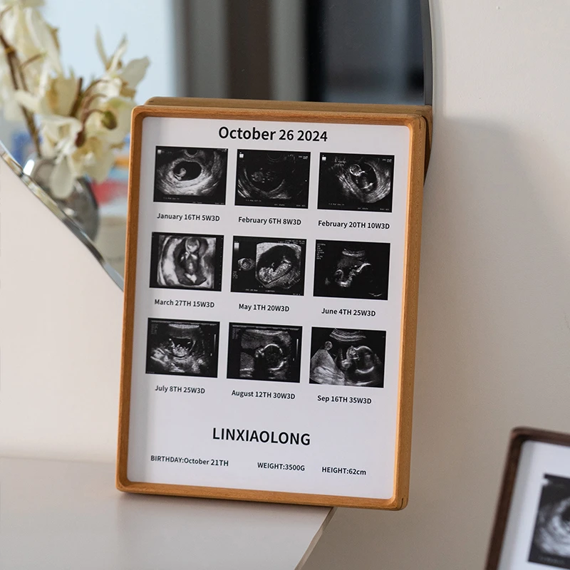 孕期B超定制宝宝四维彩超照片成长实木相框新生婴儿出生纪念礼物