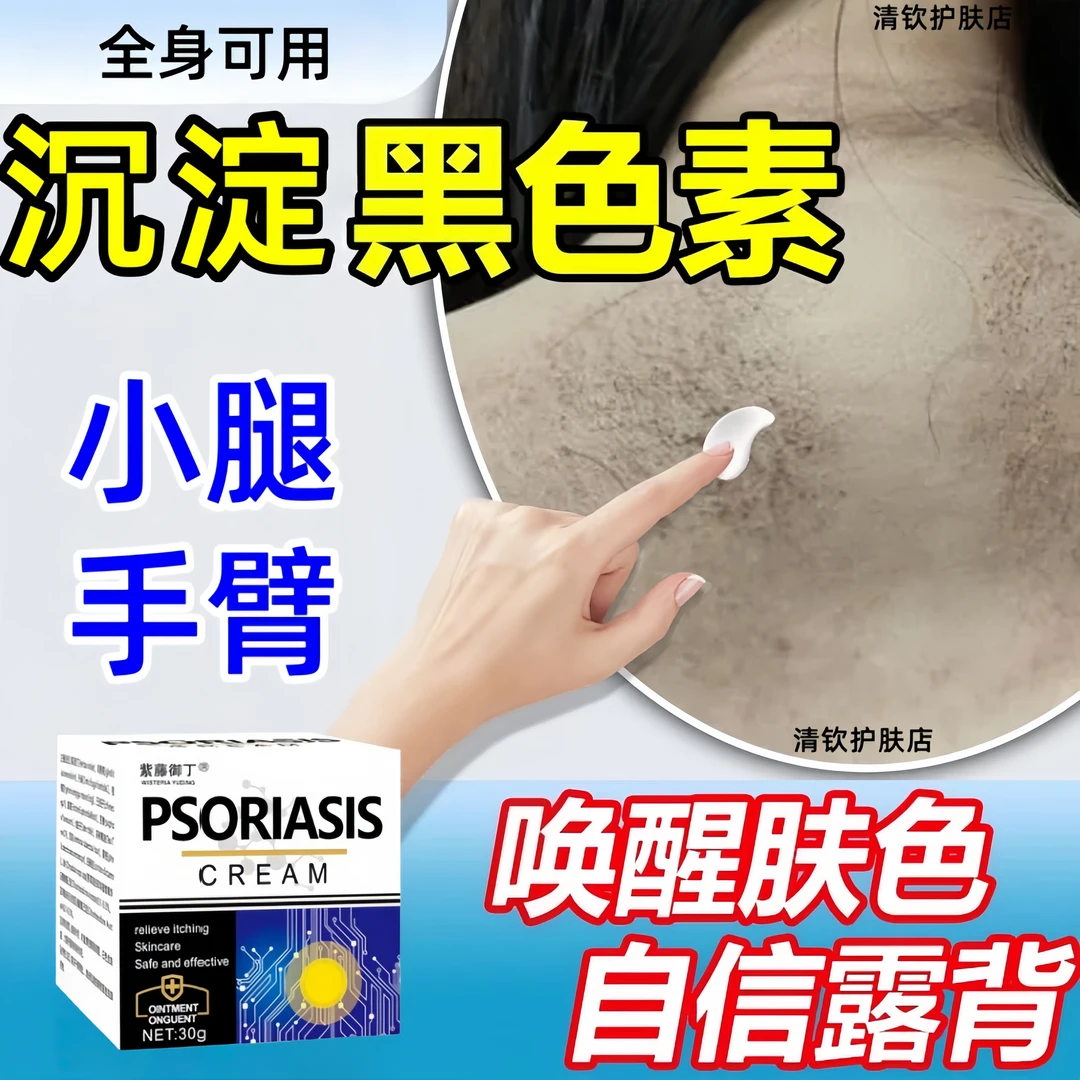手臂胳膊后背黑色素沉淀去除粗糙小腿淀粉样变沉积全身黑变白膏