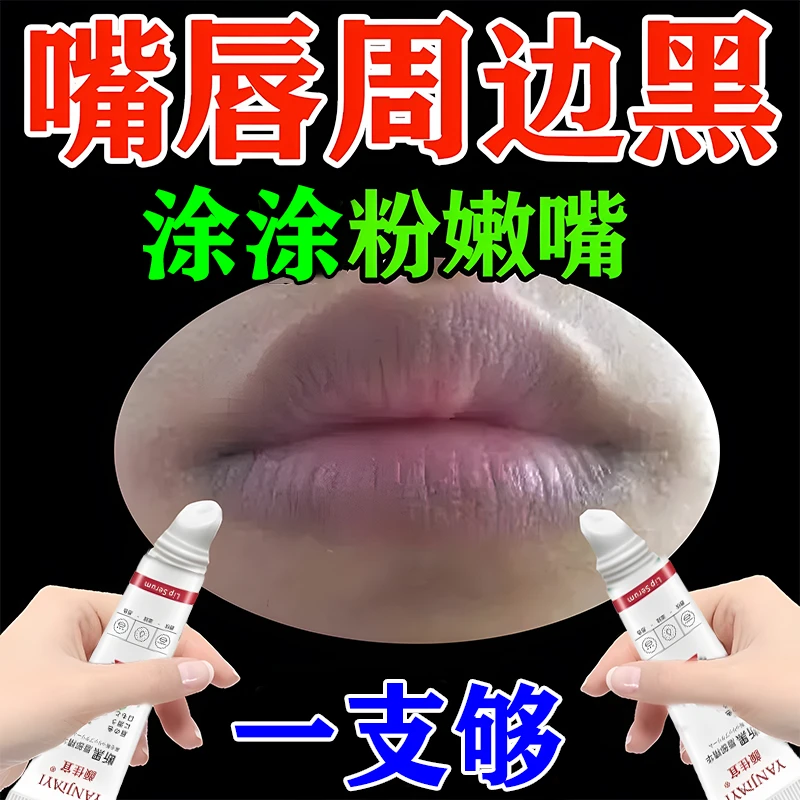 嘴唇发黑紫黑改善唇周黑嘴唇周围嘴角发黑淡化黑色素沉淀洗乌唇