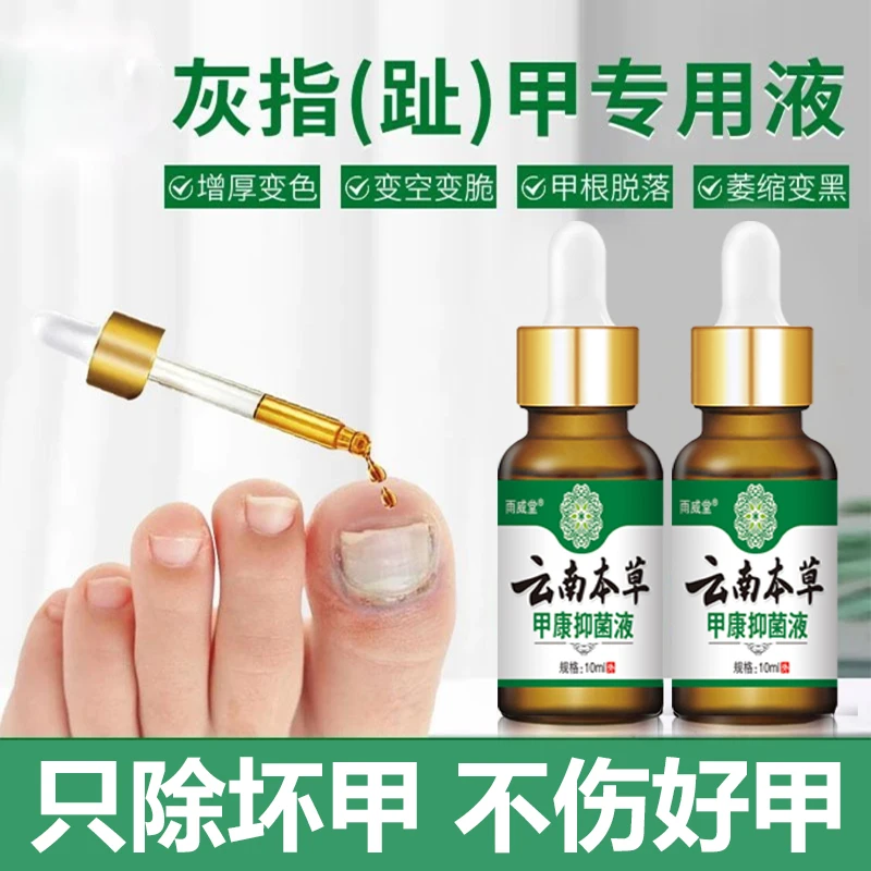 云南本草甲康液亮甲风仙花抑菌液快速去坏软甲修护脚指甲专用