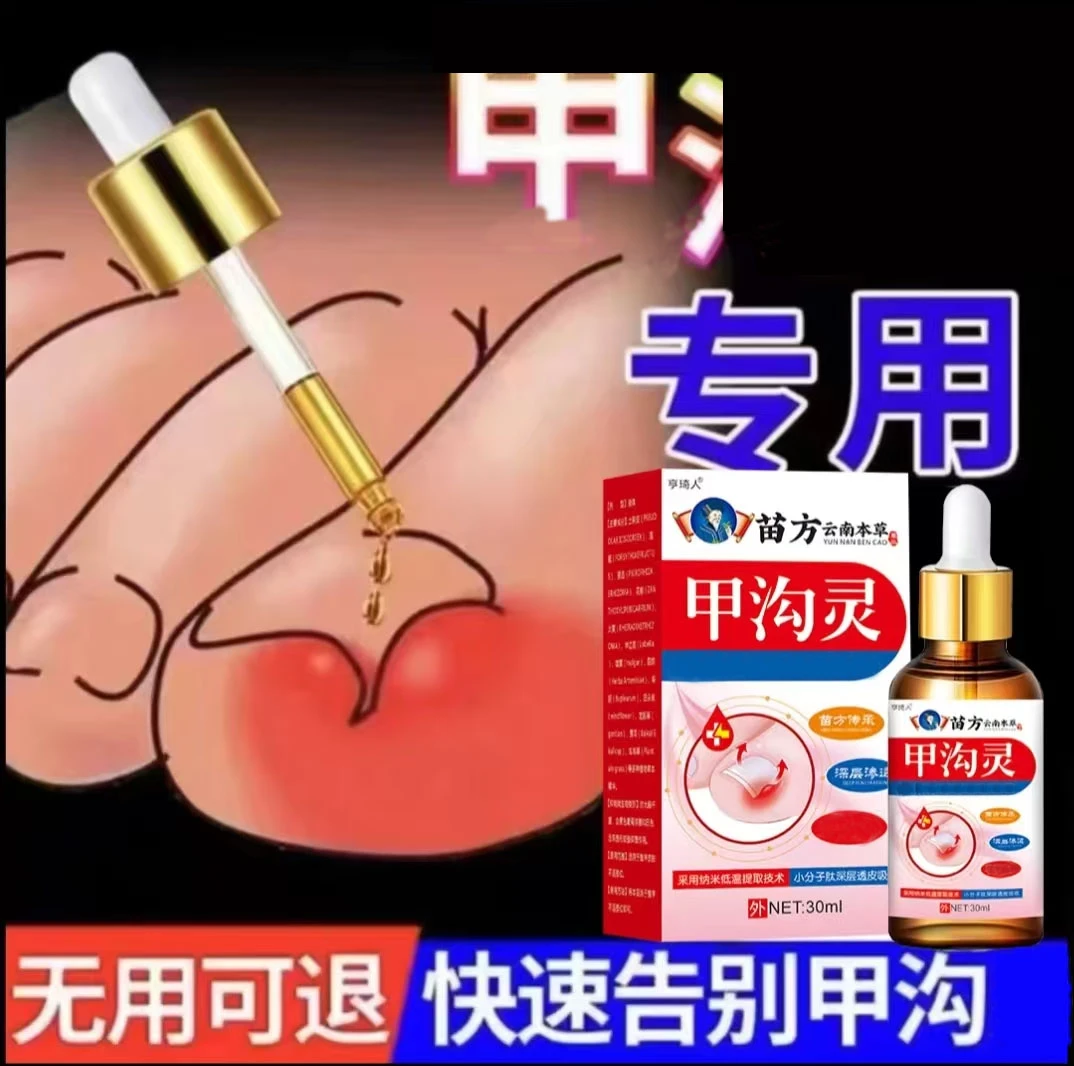 指甲长肉里甲沟软甲甲沟液快速护理草本外用原装修护脚部