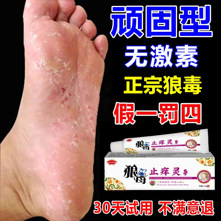 脚臭气止痒起水泡脱皮真菌特效脚趾缝痒狼毒专用喷雾克星神器