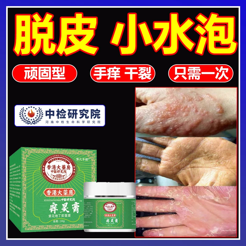 手起小水泡止痒膏王脱皮抑菌克星手指间痒干裂灵专用特喷剂效软膏
