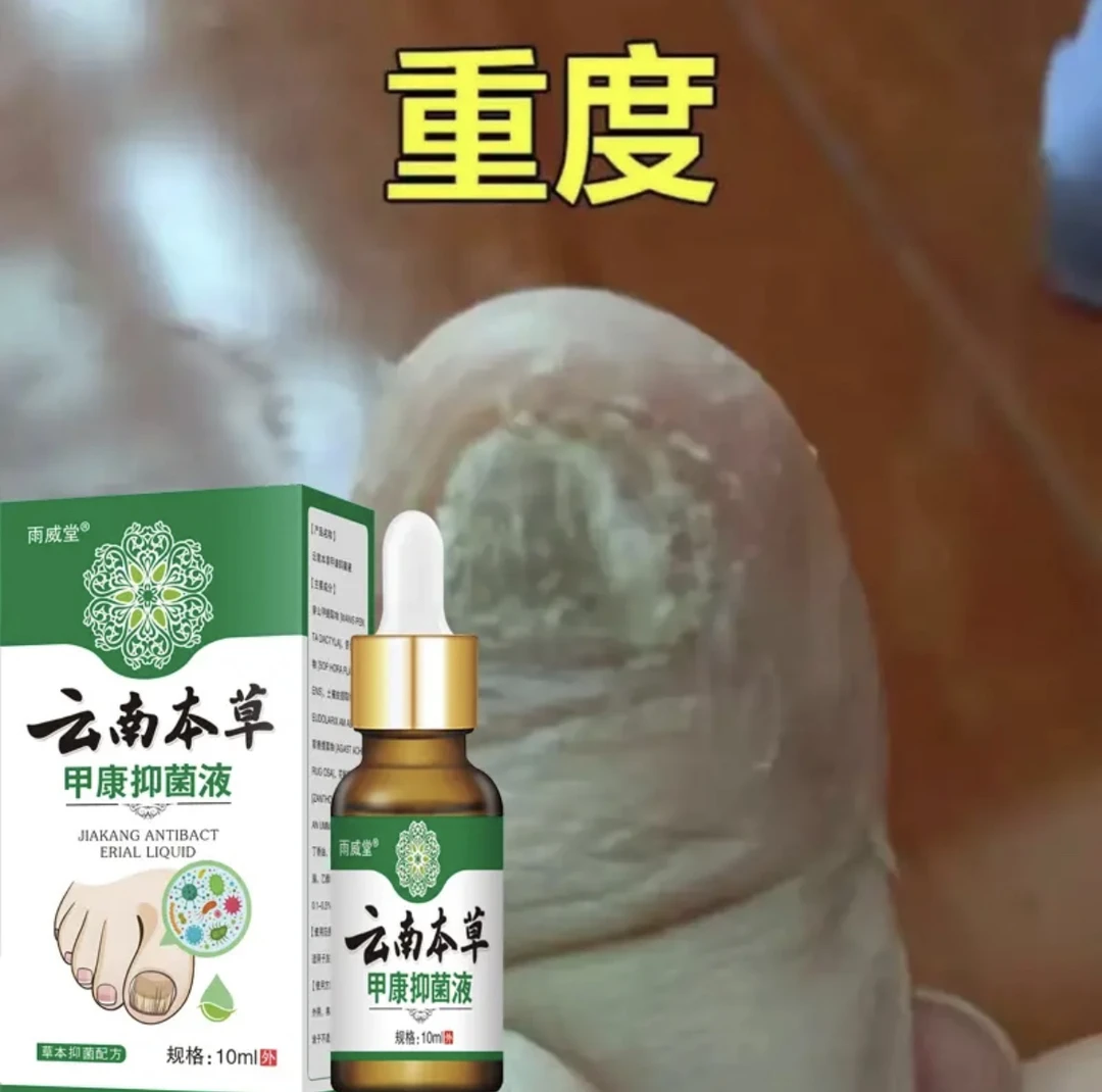 【专攻灰/指甲】云南本草甲康抑菌液指甲趾甲修护
