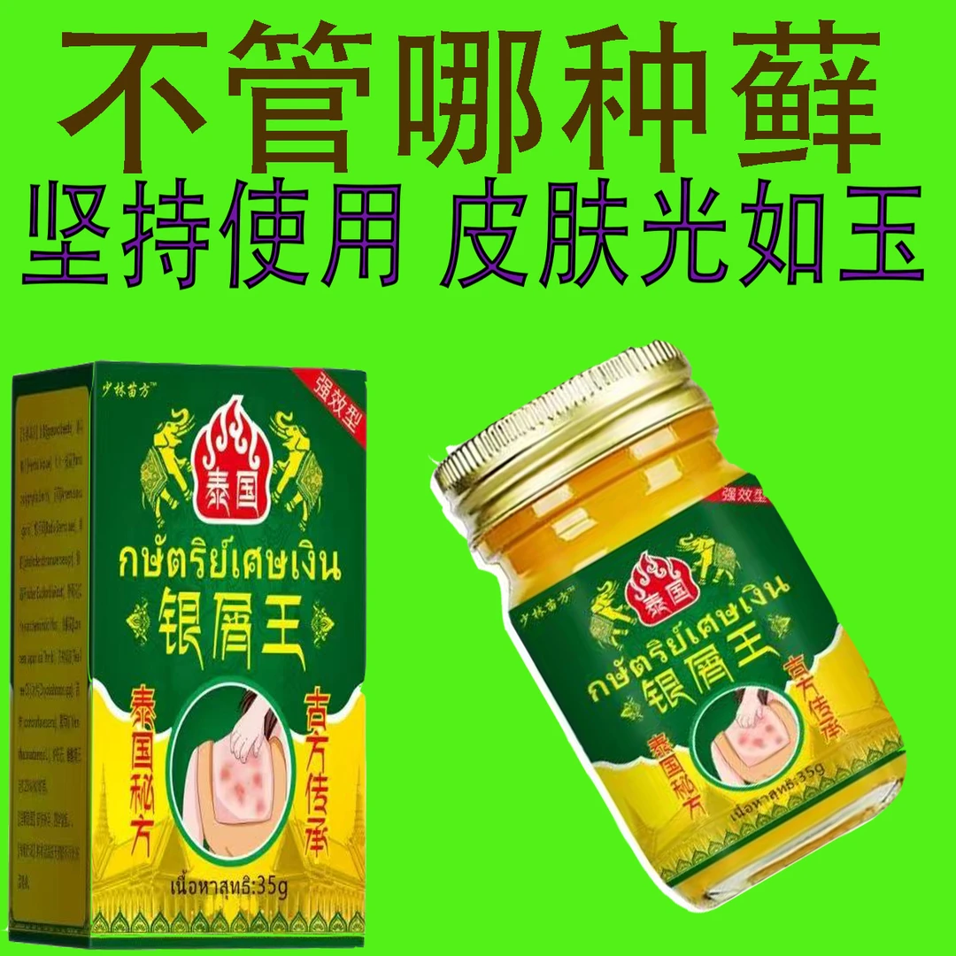 【泰国银屑王】银屑膏可用于头部及全身止痒适用于手足股和大腿内侧