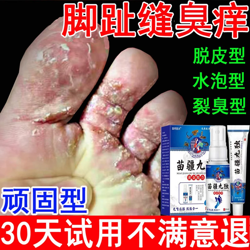 脚趾缝臭痒专用脚痒脚臭止痒膏神器脚丫脱皮抑菌膏开裂克星喷雾剂