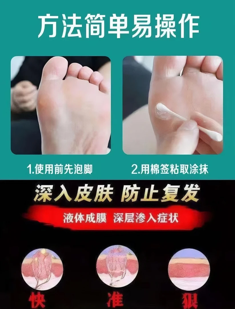 云南本草鸡茧膏脚底老茧手足脚茧温和软化去除快速