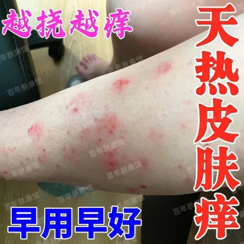 全身皮肤止痒膏湿 辰膏手足 痒抑菌乳膏特效修复正品涂抹膏