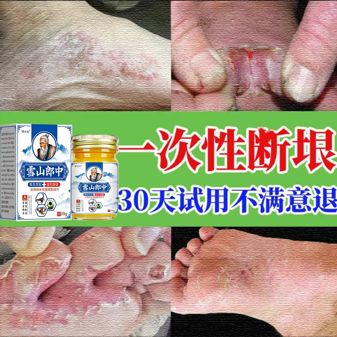 脚痒专用抑菌止痒膏脚臭干裂手足脱皮汗脚趾缝痒克星起小水泡神器
