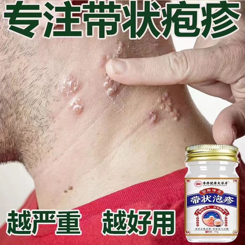 带状泡疹后遗神经痛蛇盘疮膏蛇盘清宝缠蛇龙生直器泡专用草本乳膏