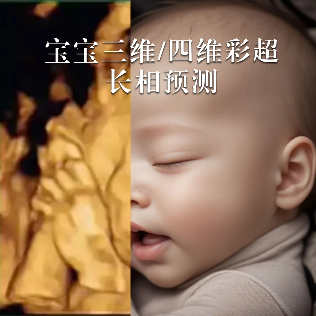 纪念礼物宝宝三维四维彩超长相预测制作定制
