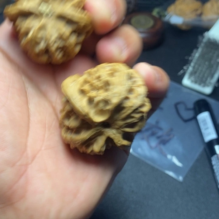 阿***_骨质密度绝对没有问题