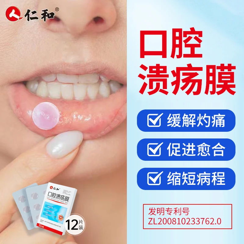 仁和口腔溃疡膜口腔溃疡贴嘴巴舌头口疮溃疡贴片缓解灼痛促进愈合12片/盒