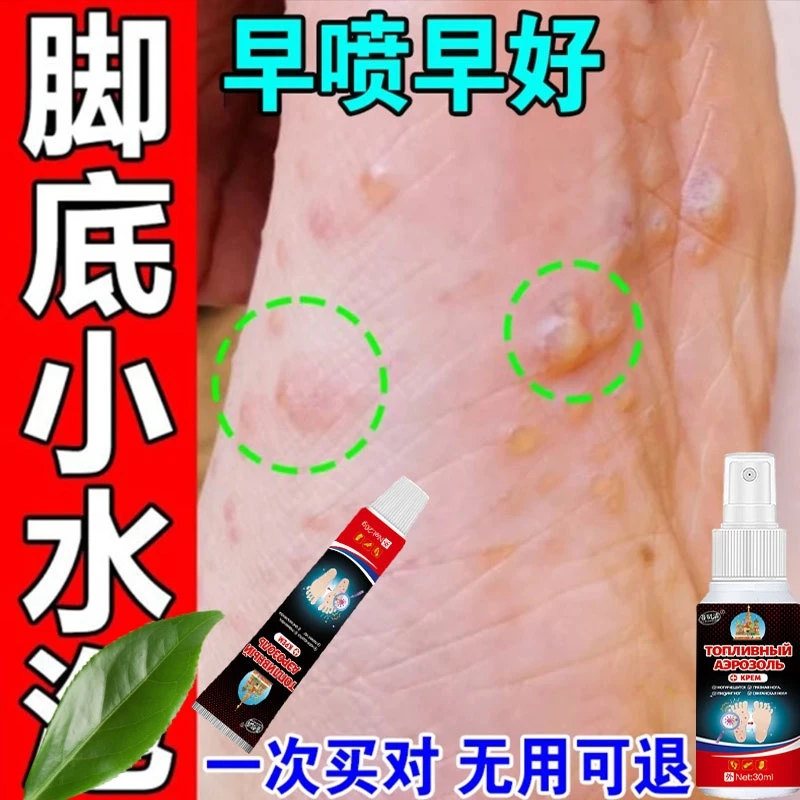 脚痒专用抑菌止痒膏脚臭气干裂脱皮汗脚趾缝痒喷剂修复克星起水泡