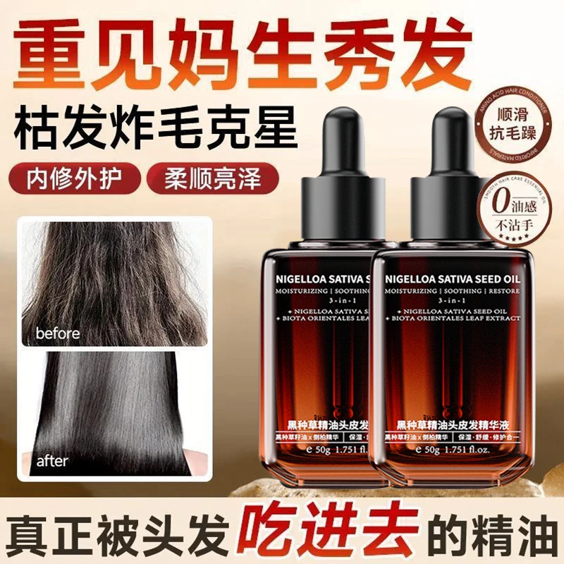 黑种草精油 黑种草籽油护发头皮按摩 养发健发精华修护养护头发