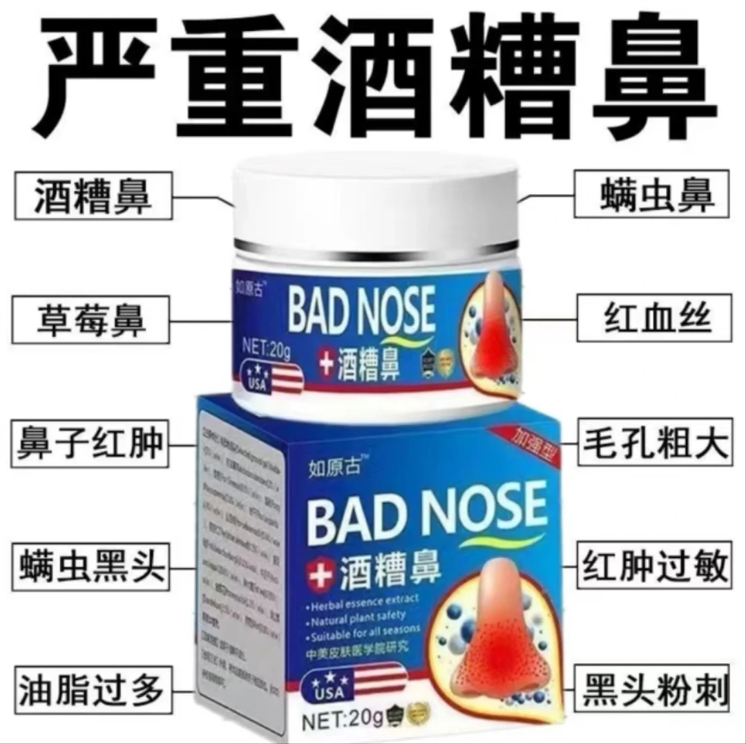 进口酒糟鼻专用红鼻子鼻翼两侧泛红去鼻头红肿草莓鼻毛孔粗大修复