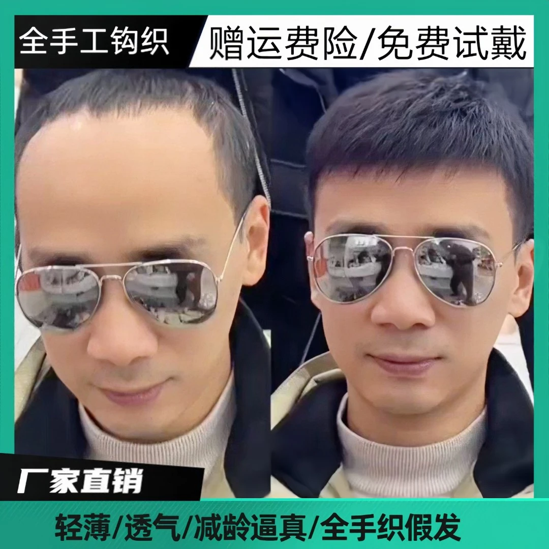 男士假发短发全真发头顶补发块无痕隐形秃头地中海可粘可卡补发片