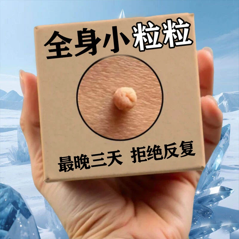 【草本乳膏】脖子腋下小圆粒小粒粒身上小黑点全身通用温和不刺激膏