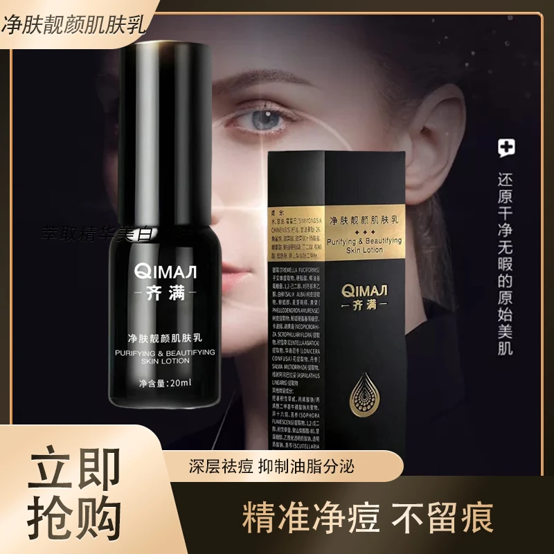 QIMAЛ齐满品牌乳精准净痘改善痘肌
