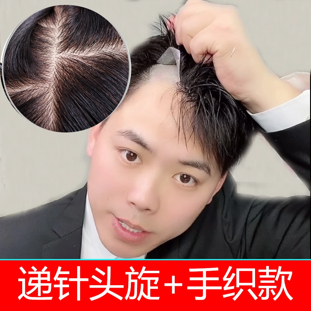 （递针旋）男士假发补发片假发块卡子胶片真发假发男生补发秃顶假发