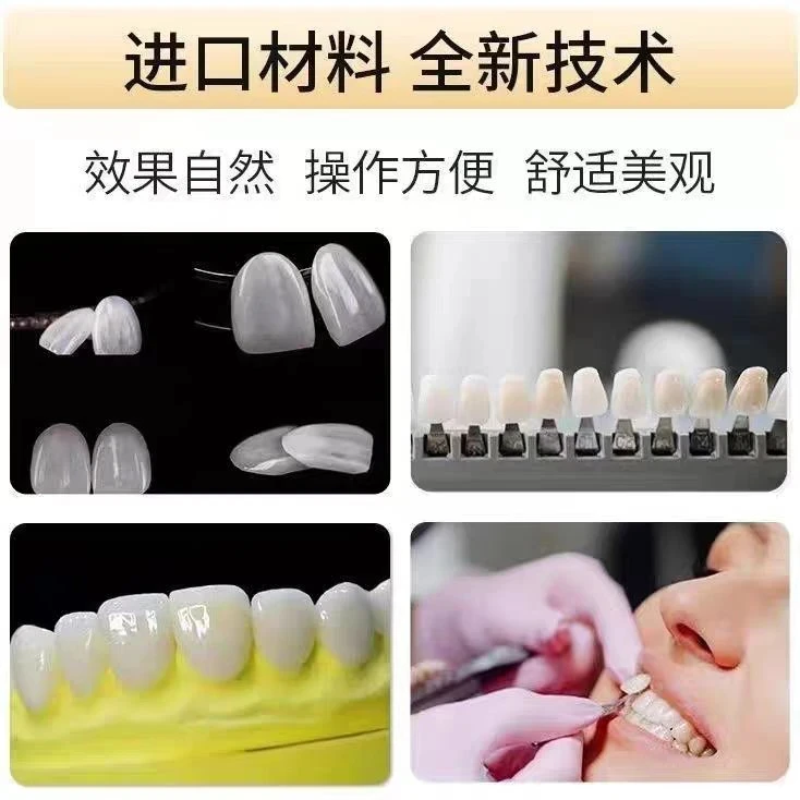 美白牙贴.进口全瓷牙贴超薄