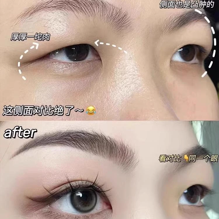 法国官方大牌正品双眼皮贴斜切橄榄自然隐形无痕迷你局部调整内双