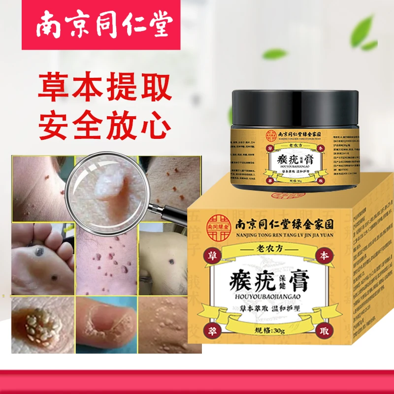 南京同仁堂克优脖子小肉粒脸部腋下额头扁平丝状快速瘊子脱落膏