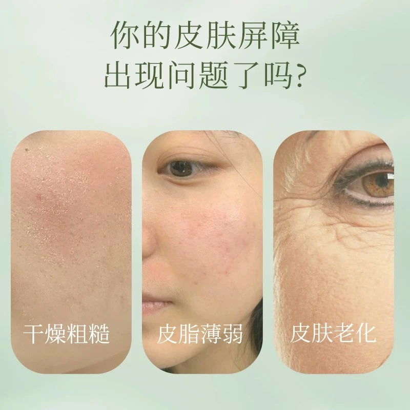 阅肤皮脂精华素修护皮肤屏障保湿滋润舒缓抗皱修护面部精华乳