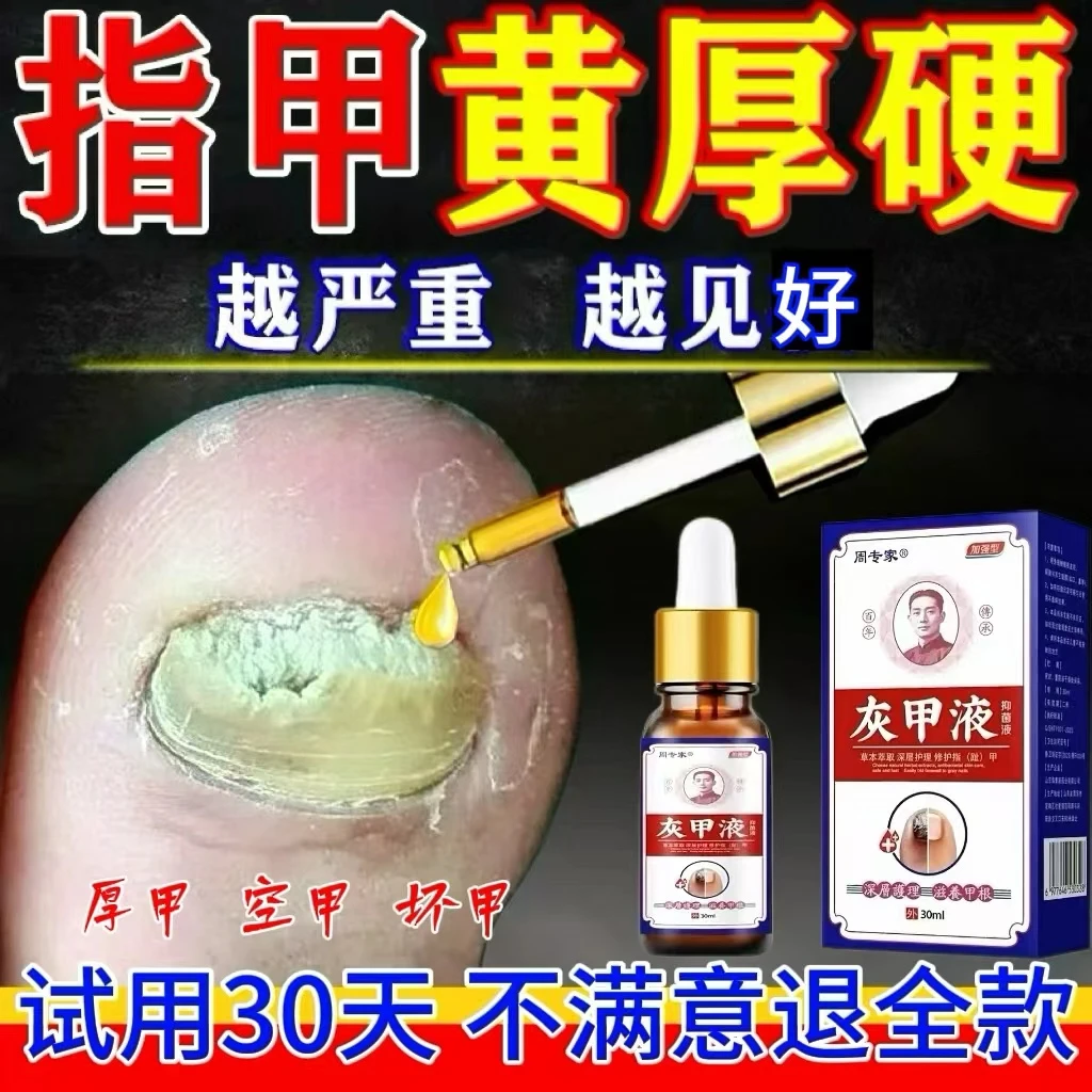 手指趾甲专用抑菌液亮甲正品发灰发黄增厚脚指甲专用抑菌液