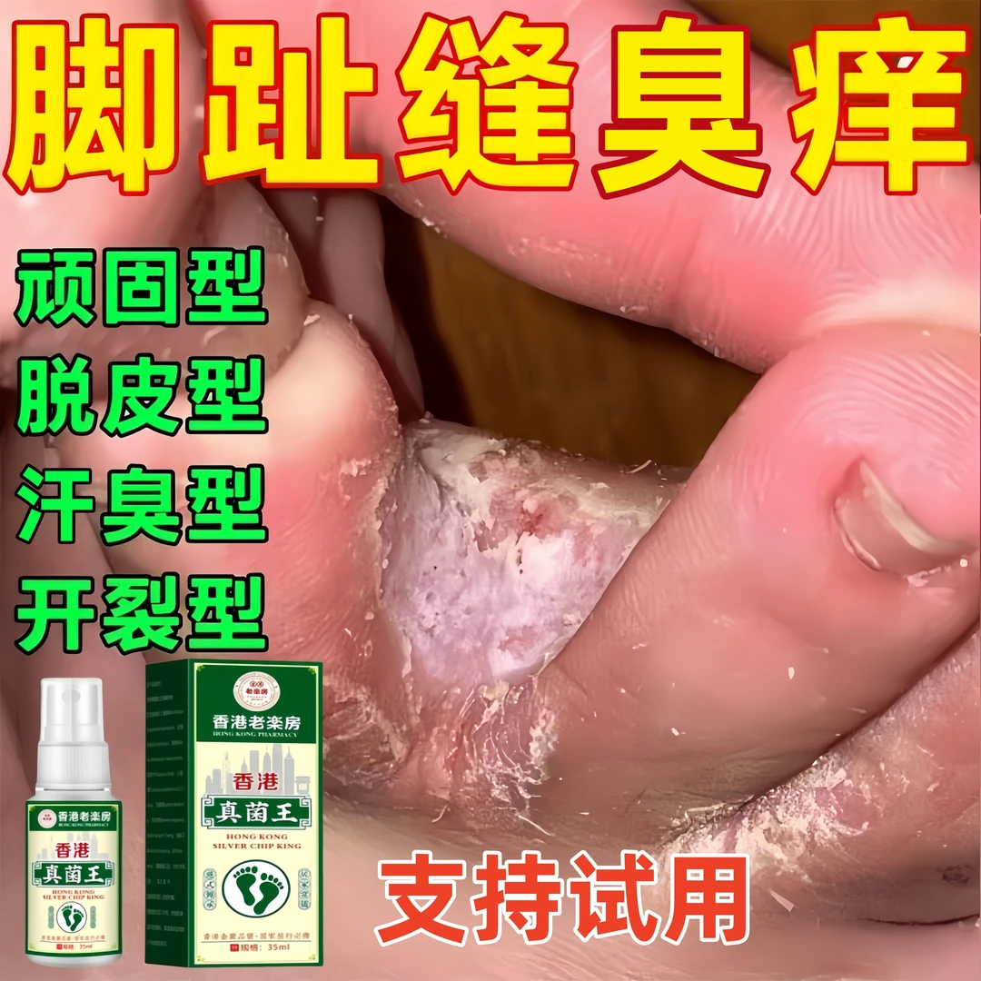 脚趾缝痒专用去脚痒脚臭气止痒神器脚丫脱皮抑菌膏开裂克星喷雾剂