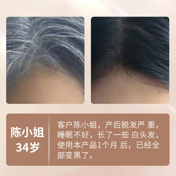 植萃精华液对白发的效果展示