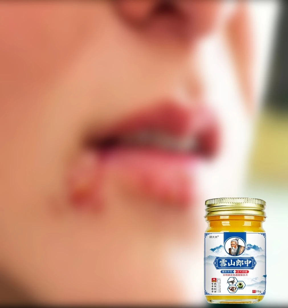 嘴巴干裂起皮脱皮痒上火起小小泡外用涂抹膏脸部