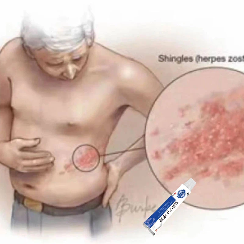 全身皮肤止痒膏湿 辰膏手足 痒抑菌乳膏特效修复正品涂抹膏