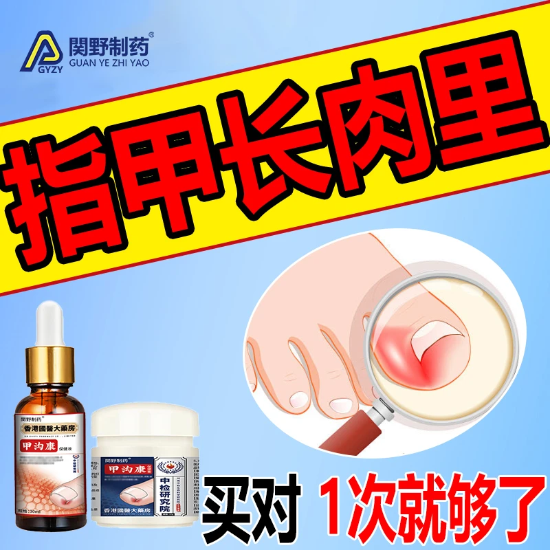指甲长肉里甲沟软甲脱甲脚趾甲嵌甲肉芽脚指头疼甲沟膏