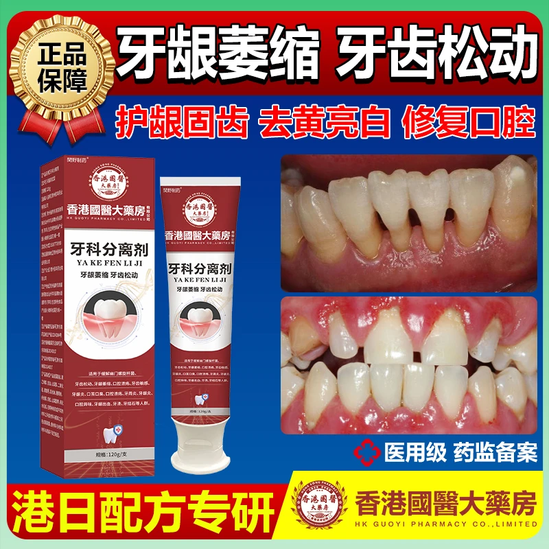 牙周炎症牙齿敏感牙龈出血牙龈肿痛牙齿松动肿胀出血牙结石牙龈萎缩幽门螺旋杆菌减臭留香亮白牙齿护龈护齿曲延康医用口腔脱敏膏