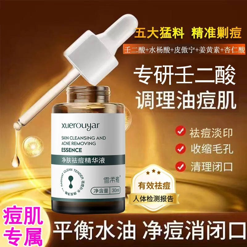 壬二酸精华液祛痘精华水杨酸祛痘印修复淡化痘印黑头粉刺收缩毛孔