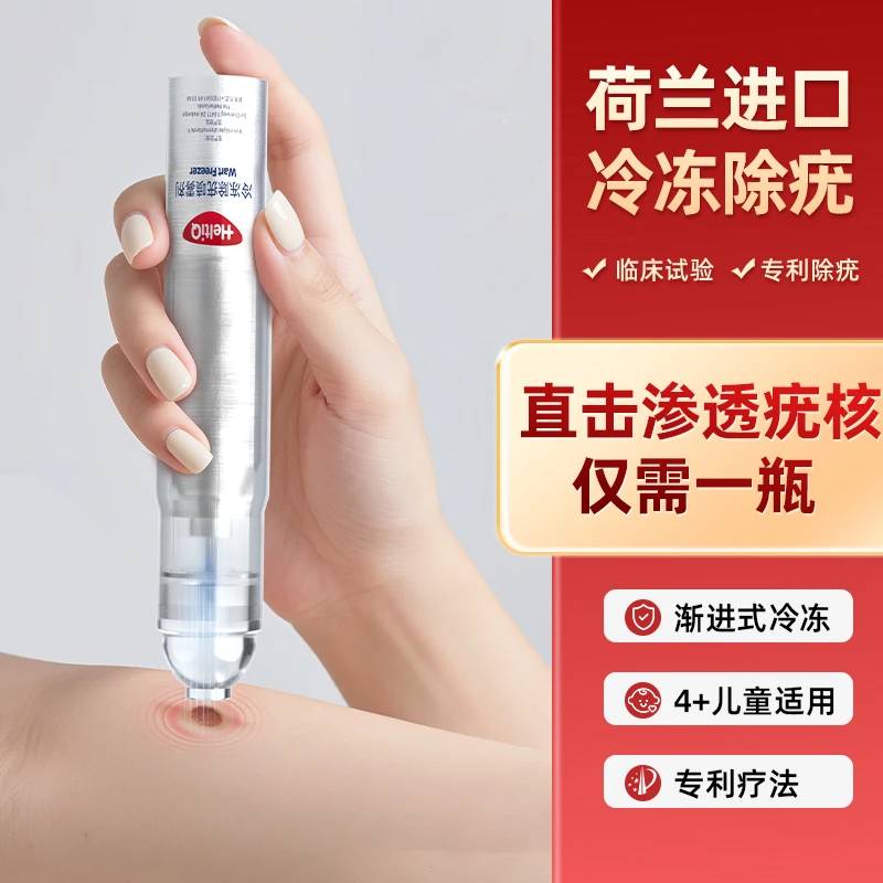 荷迪优荷兰进口冷冻除疣喷雾剂Wart Freezer冷冻去疣低温去除寻常疣传染性软疣非液氮脖子脸上长疣