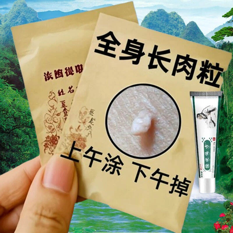 【不好用砸店】草本身上钉手足寻常脖子腋下肉粒扁平寻常疙瘩温和