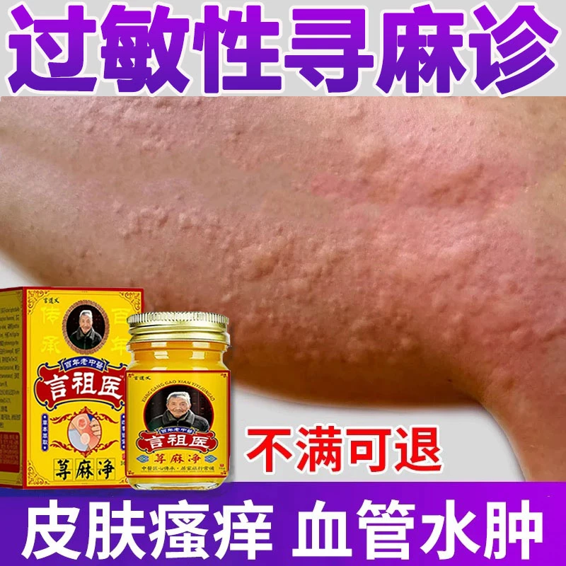荨麻诊专用止痒膏过敏急慢性胆碱划痕风团性皮肤瘙痒湿痒止痒膏