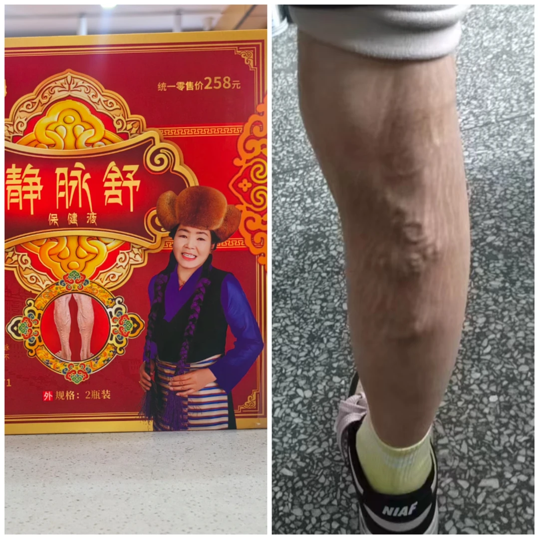 静脉舒送护膝护腿身体舒缓瓶装草本礼盒装