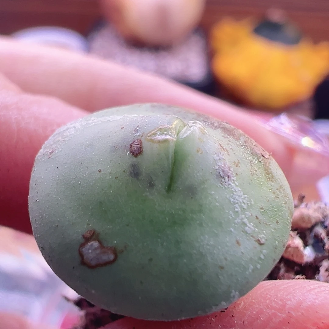 玻尿酸嘟嘟嘴。