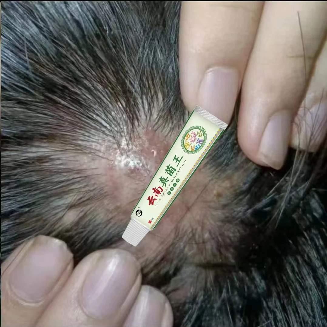 【云南真菌王】头皮毛囊起小红疙瘩脓包头皮屑多头皮痒修复膏真菌王