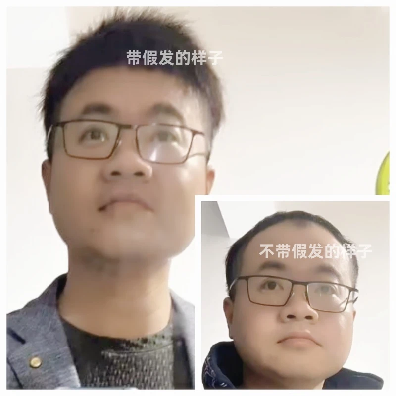 小函男士假发片头顶补发块秃顶地中海假发前额补发自然真发假发片