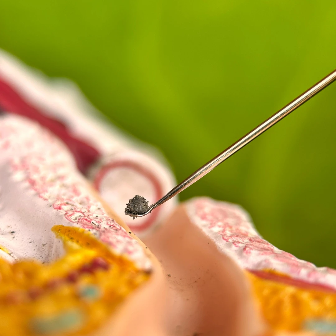 （瓢瓢）不锈钢挖耳勺可视掏耳防锈便携手工套装小头款采耳耳扒圆头